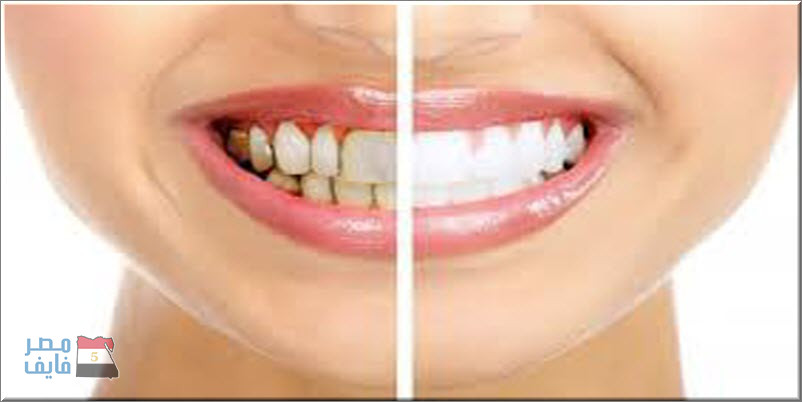 بزيت طبيعي واحد يمكن تبييض الأسنان وترطيب البشرة وتعطيرها
