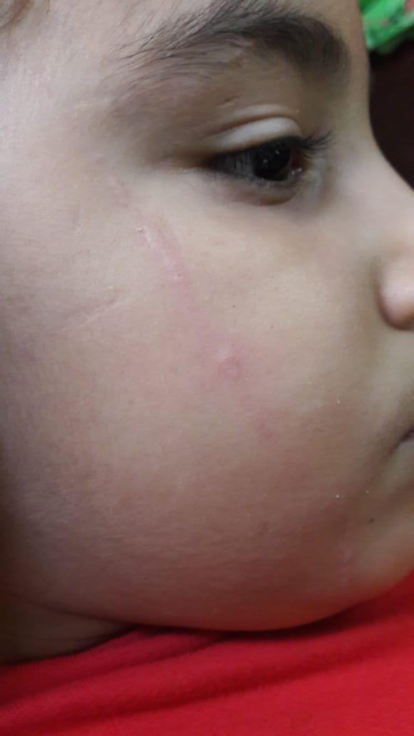 بالصور -أصابته بهيستيريا.. معلمة تضرب تلميذًا بمسطرة على وجهه لأنه أمسك المصحف 7