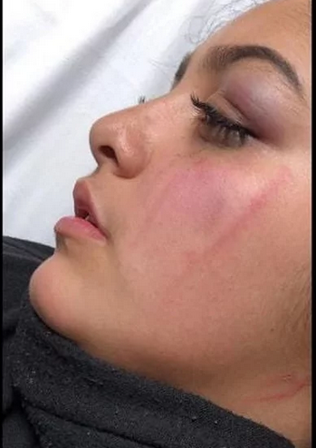 بالصور| تفاصيل الاعتداء على فتاة في أتوبيس عام بسبب حجابها 4