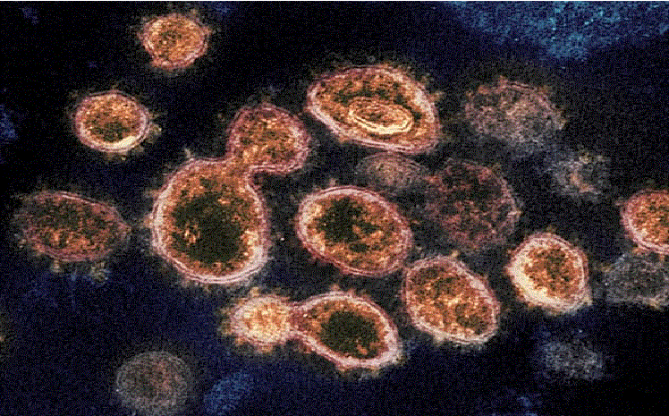 ” فيروس كورونا ” كم يعيش على الأسطح .. إليك كل ما تحتاج إلى معرفته