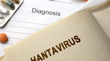 اعراض فيروس هانتا Hantavirus واسباب الإصابة به