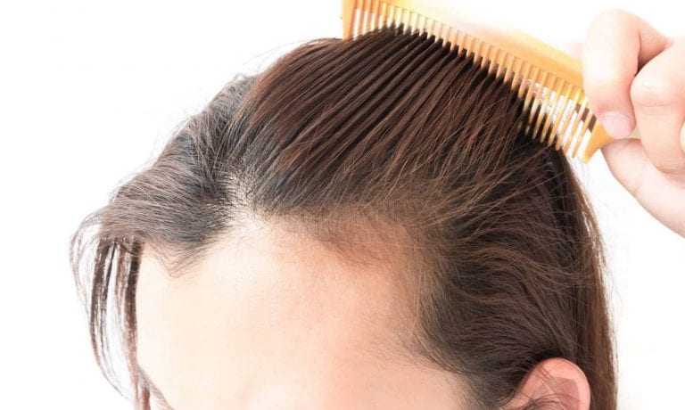 ما سبب تساقط الشعر بكثرة ؟ 13 سبب تعرف عليها مع أهم طرق العلاج