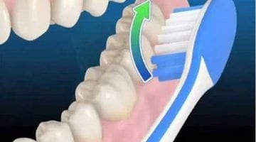 أفضل طرق تبييض الأسنان وعلاج اصفرارها