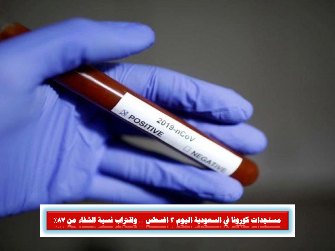 مستجدات كورونا في السعودية اليوم 3 اغسطس .. واقتراب نسبة الشفاء من 87%