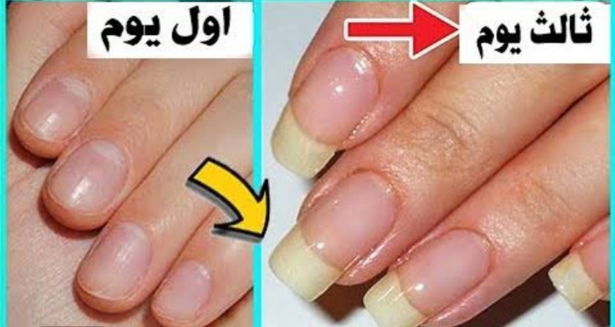 Naturally grow nails in 5 days with ingredients from your kitchen