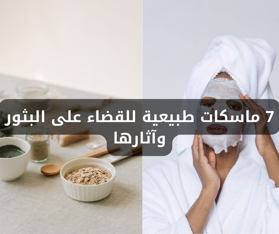 7 ماسكات طبيعية للقضاء على البثور وآثارها